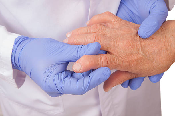 Rheumatoid Arthritis