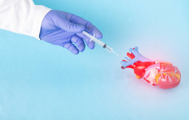 Atrial Fibrillation Surgery (Maze Procedure)