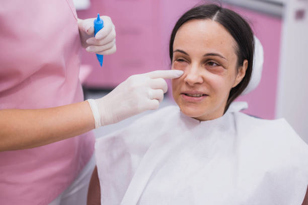 Squint Correction Surgery