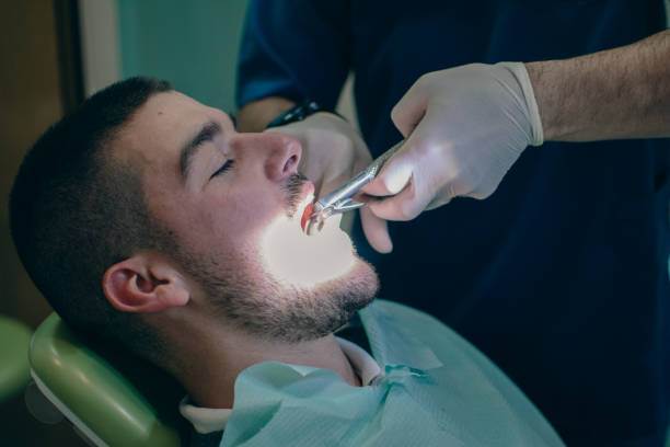 Tooth Extraction