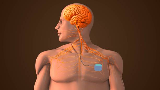 Deep Brain Stimulation (DBS)